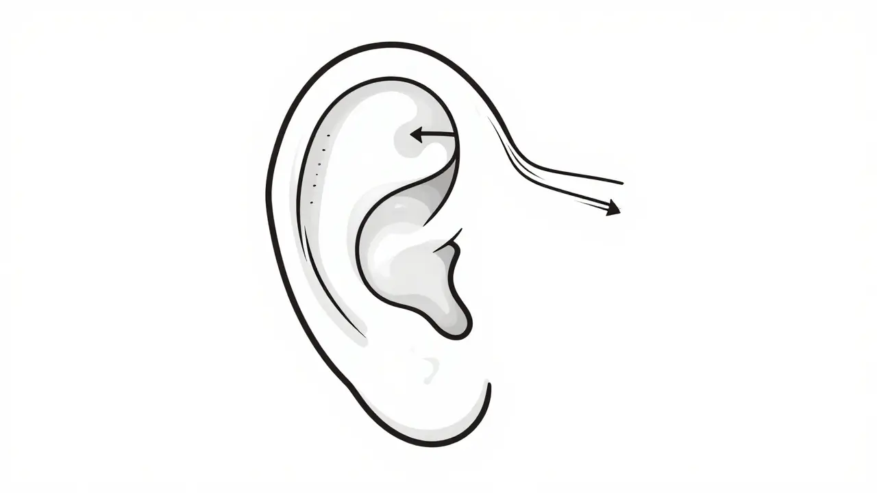 Schematic line art of the ear anatomy showing fluid blockage